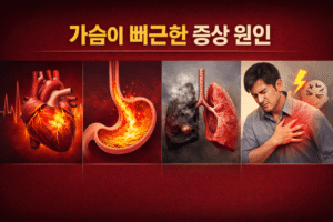 가슴이 뻐근한 증상